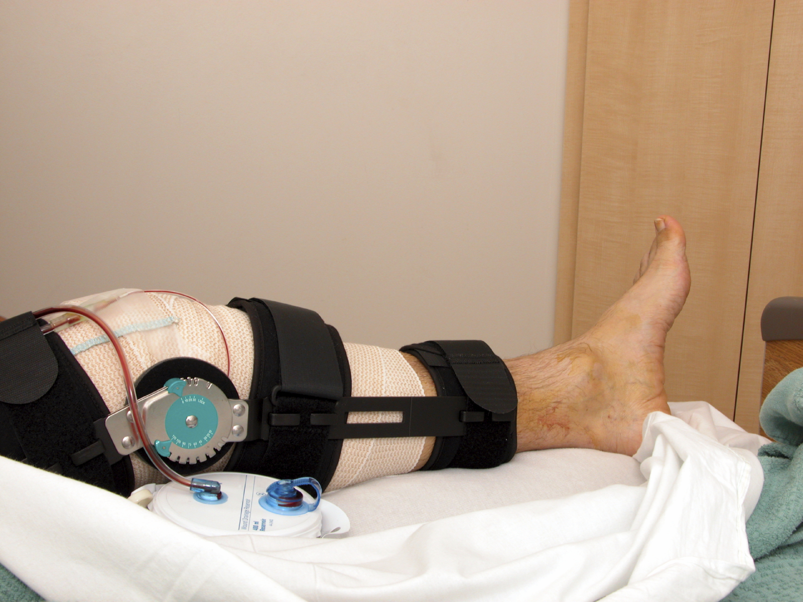 ACL Surgery Recovery Timeline OSG