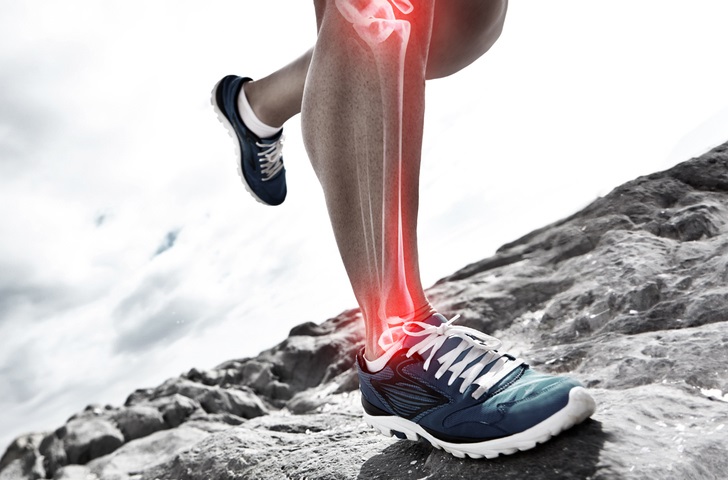 shin splints causes symptoms treatments
