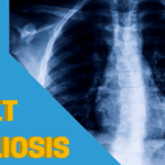 What is adult scoliosis