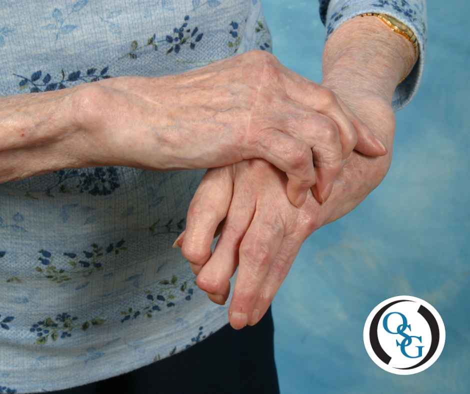 A woman grabbing at her arthritic hands